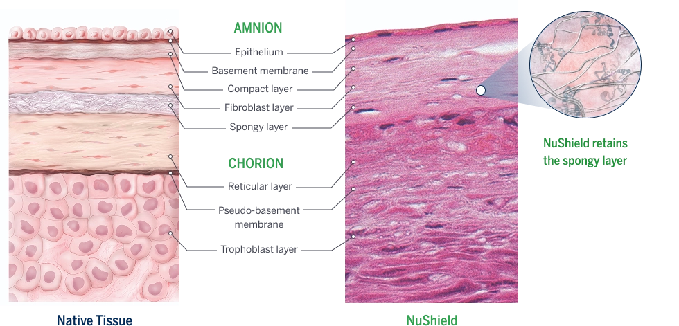 Native tissue vs NuShield histology